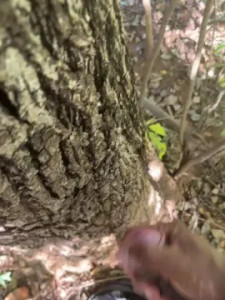 View the full clip titled negrodovitiligo, 36 years old, male